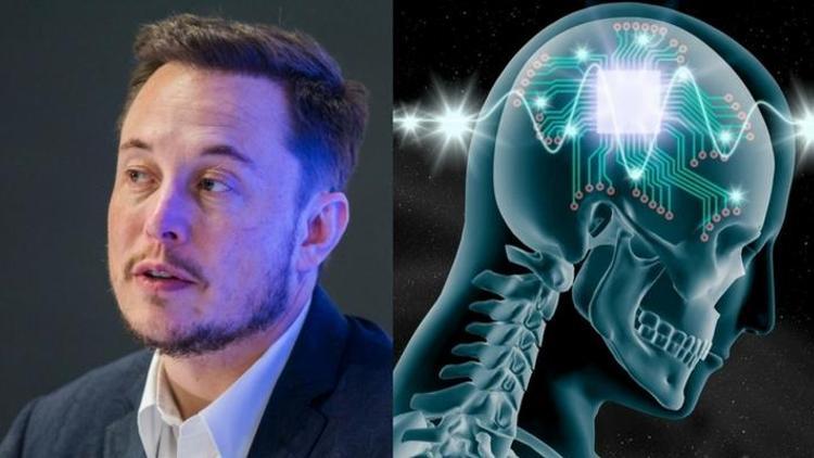 NeuraLink nedir İşte Elon Muskın yeni çılgın projesi