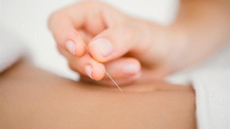 Akupunktur İle Kilo Vermek Mümkün mü?
