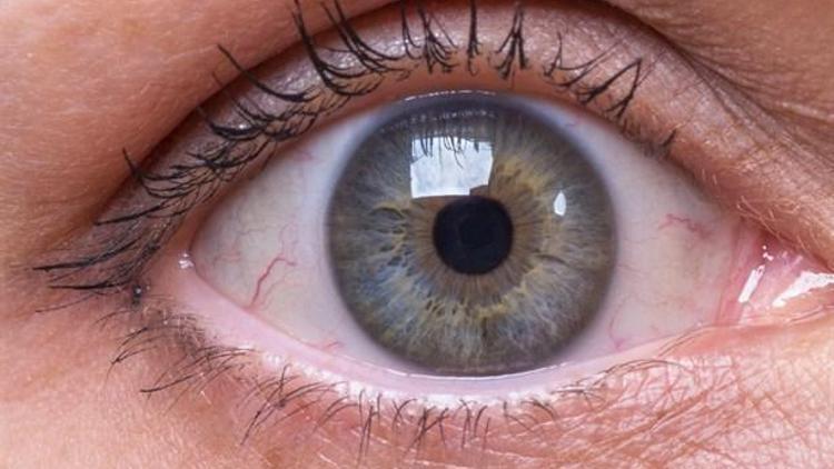 Göz Alerjileri Tedavi Edilmezse Göz Kaybına Neden Olabiliyor