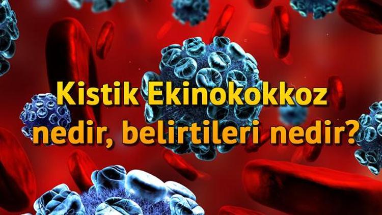 Kistik Ekinokokkoz nedir, belirtileri nedir