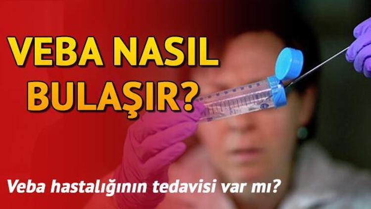 Veba nedir İşte veba hastalığı belirtileri ve tedavisi hakkında bilgiler