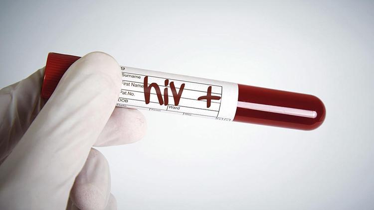 Yeni HIV türü keşfedildi