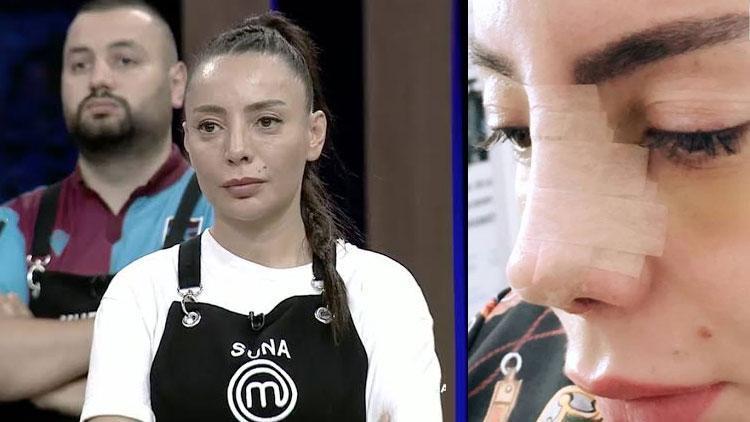 MasterChef Suna estetik oldu... İşte son hali