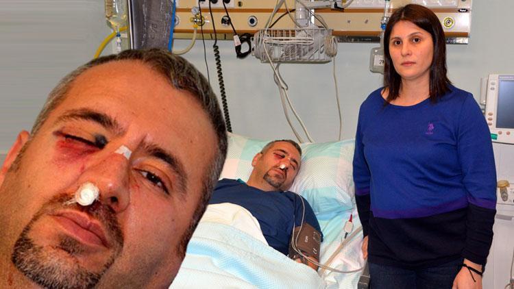 Hastanede korkunç saldırı Sağlık teknikerinin elmacık kemiği kırıldı