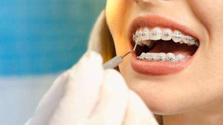 Bilinenin aksine ortodontik tedavi her yaşta yapılıyor  