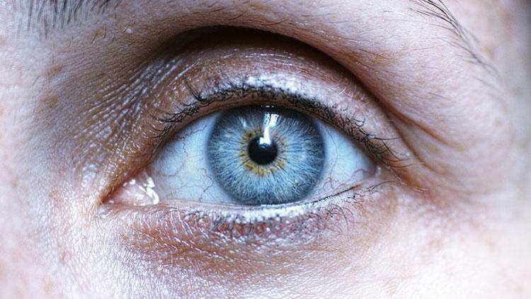 Türklerin %95’inin gözleri ışığa karşı hassas