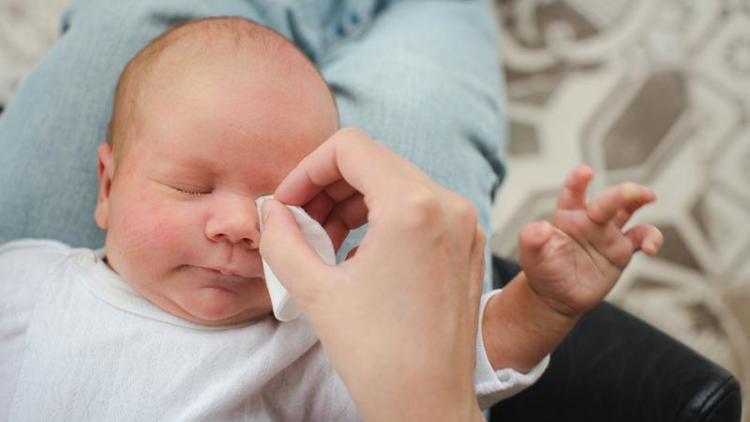 Bebeklerde gözyaşı kanal tıkanıklığı masaj ile açılabilir
