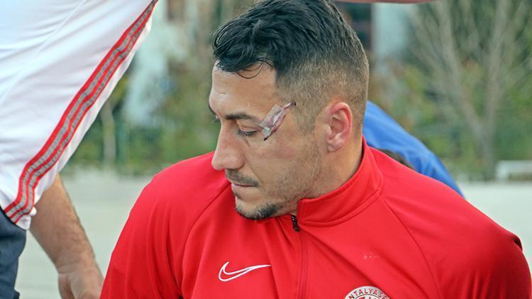 Antalyaspordan Adis Jahovic korkuttu Kafasında çatlak tespit edildi