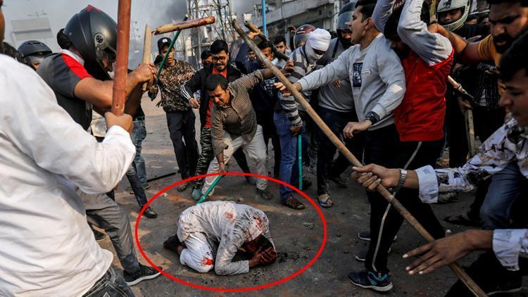 Yeni Delhideki vahşette öldüresiye dövülen Muhammed Zübeyir yaşadıklarını anlattı