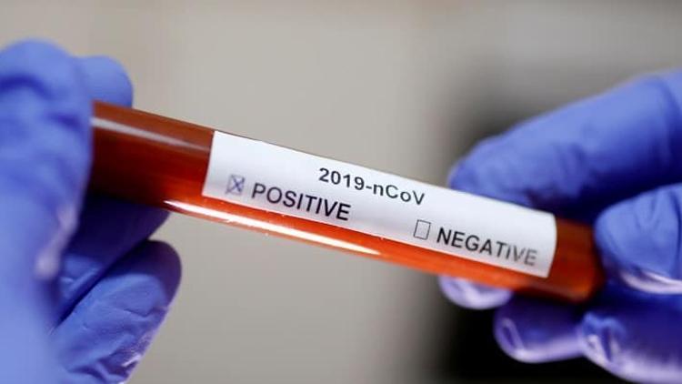 Yeni Zelandada ilk koronavirüs vakası tespit edildi