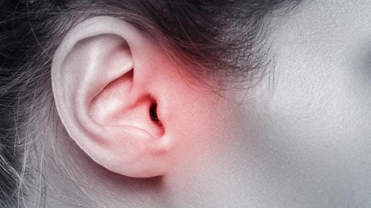 Kulak iltihabına ne iyi gelir? Kulak iltihabı neden olur ve nasıl geçer?