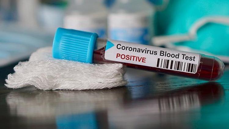 Son dakika haberi: Corona virüs Kongo Demokratik Cumhuriyetine de sıçradı