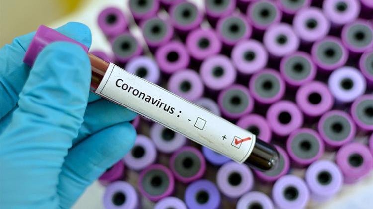Koronavirüs Sindirim Yoluyla Bulaşmıyor