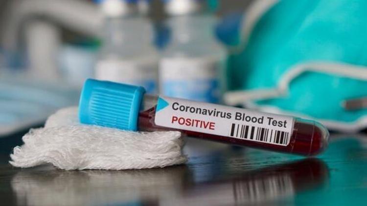 İsrailde yeni tip koronavirüs vaka sayısı 2 bin 693e yükseldi