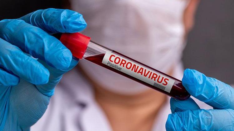 Böbrek hastaları koronavirüs enfeksiyonundan nasıl korunmalı?