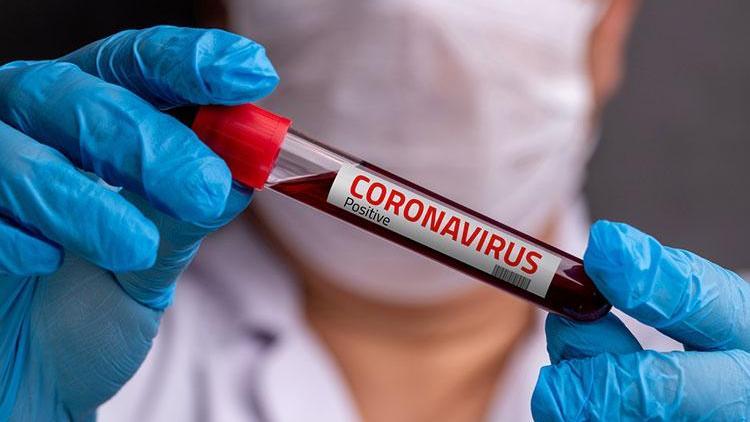 Bilim kurulu üyesi Prof. Dr. Ateş Kara, koronavirüsle ilgili merak edilenleri açıkladı