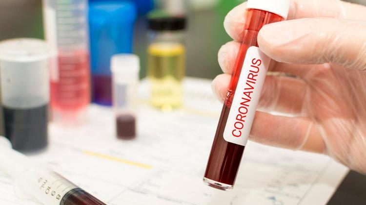 HPE, koronavirüs için 2 milyar dolar kaynak ayırdı