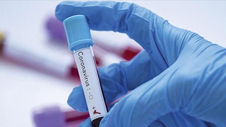 Avrupa İlaç Ajansı: Corona Virüs aşısının üretimi en az 1 yılı bulacak