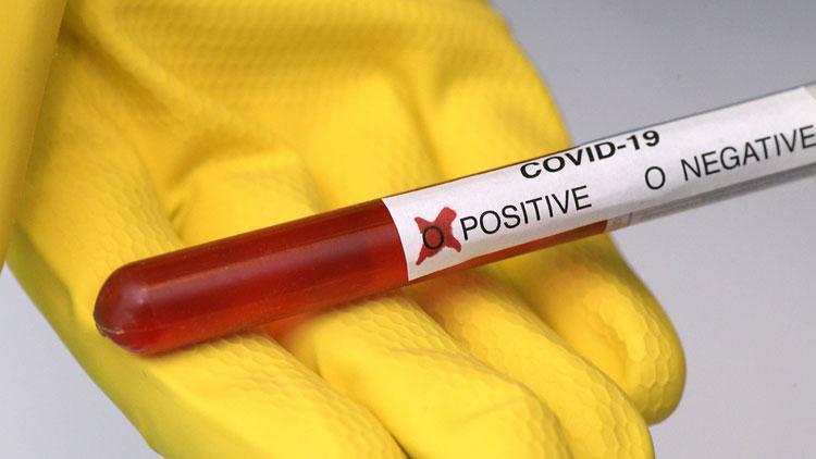 Fransa koronavirüs tedavisinde kullanılan o ilacı yasakladı