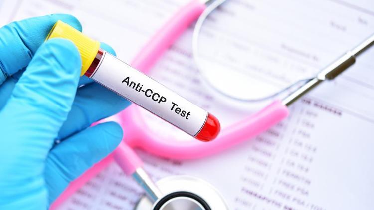 Anti Ccp testi nedir? Nasıl yapılır?