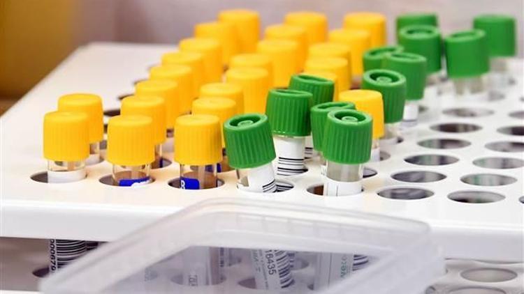 İspanyada koronavirüsten ölenlerin sayısı 28 bin 341e çıktı