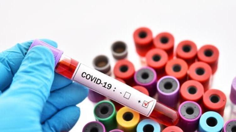 ABDde 285 çocukta Covid-19a bağlı iltihaplanma sendromu görüldü