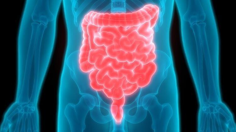 Crohn hastalığı nedir, belirtileri neler Crohn hastalığı ile ilgili bilgiler