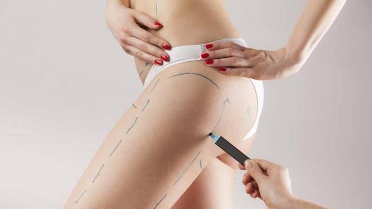 Vaser liposuction ameliyatı sonrası neler yapılmalı