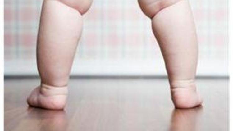 Çocuklardaki obezite nasıl önlenir?