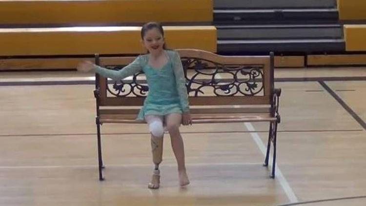 Protez bacağıyla sınır tanımayan inanılmaz kız!
