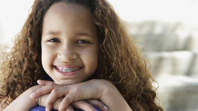 Çocuğunuz hangi tip diş teli kullanmalı?