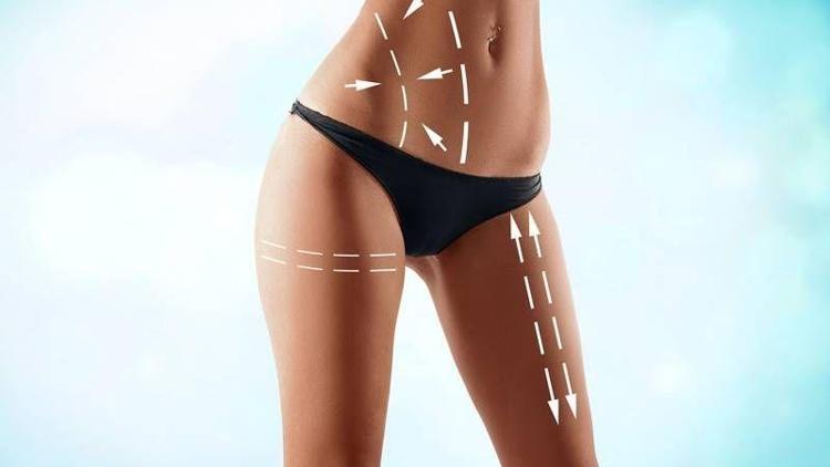 Liposuction kalıcı bir işlem midir?
