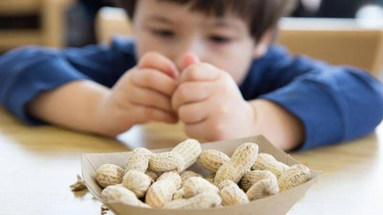 Her 13 çocuktan 1’inde besin alerjisi görülüyor