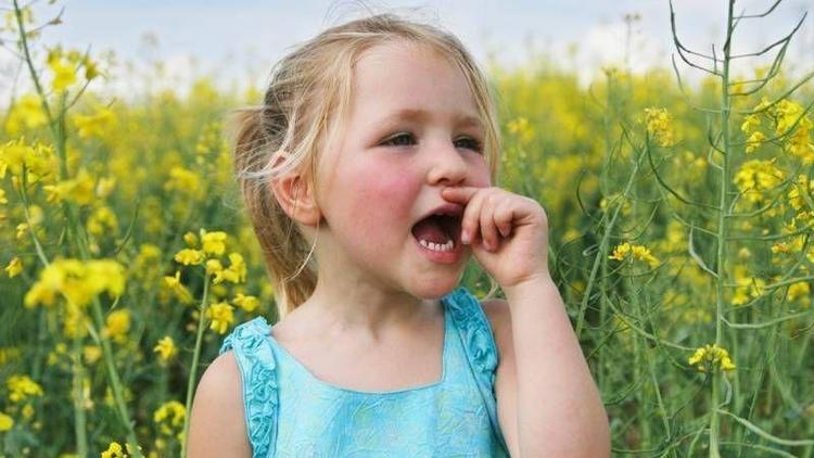 Çocuklarda alerji olduğu nasıl anlaşılır?