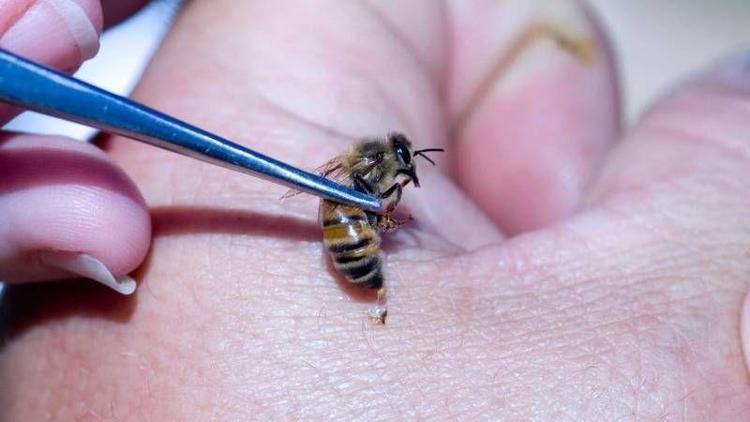 Arı sokmasına iyi gelen doğal yöntemler
