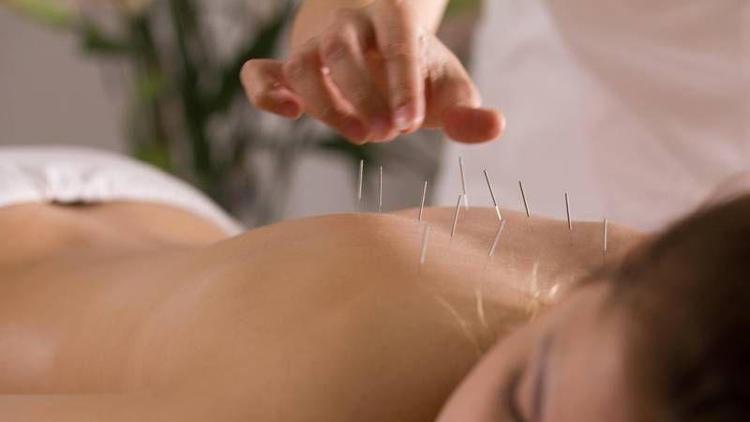 Akupunktur hangi hastalıklara uygulanır?