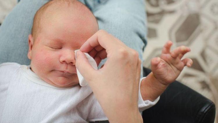 Bebeklerde göz çapaklanması neden olur?