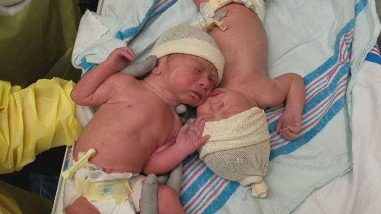 Yeni doğan ikizlerin sevgi bağı duygulandırıyor