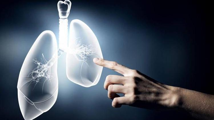 Akciğer kanseri olduğunu öğrenen kişi ne yapmalı?