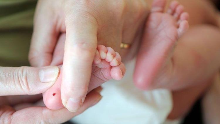 Bebeklerde topuk kanı testi neden yapılır