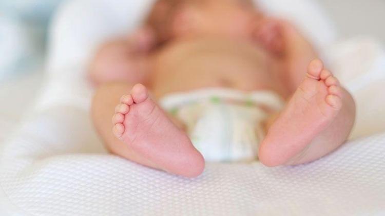 Bebeklerde çarpık ayak nasıl tedavi edilir?