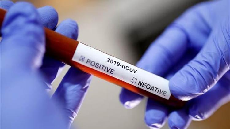 ABDde koronavirüsten son 24 saatte 452 ölüm