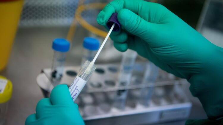 Şanlıurfa İl Sağlık Müdürlüğünden PCR testi açıklaması Sorun giderilmiştir