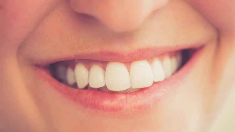 Dişlerde flor uygulaması zararlı mı yararlı mı?