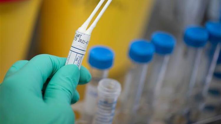 Suudi Arabistanda koronavirüs salgınında son rakamlar açıklandı