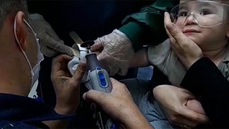 Silivri’de çocuğun metal parçaya sıkışan parmağı operasyonla kurtarıldı