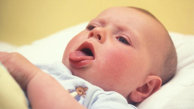 Reflüsü olan bebekleri rahatlatacak 10 öneri