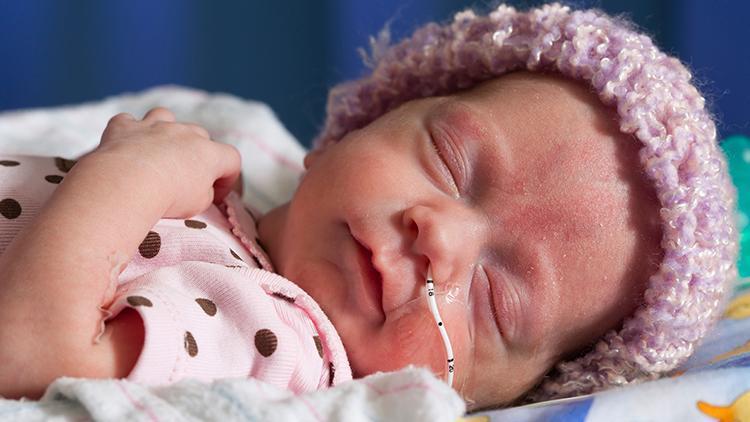 Prematüre bebeklerin sağlıklı gelişimi için nelere dikkat edilmeli?