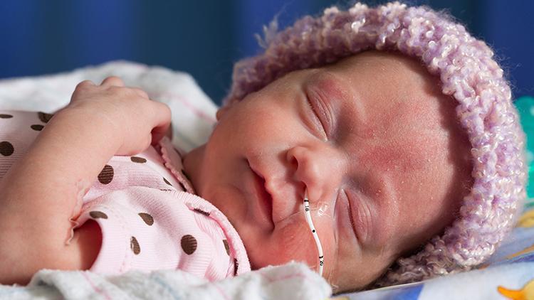 Erken doğan bebeklerde göz problemleri oluşabilir