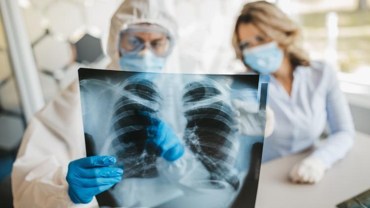 Akciğer Hasarı Kök Hücre ile Tedavi Edilebilir mi?